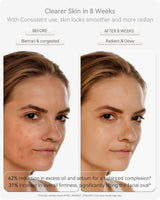 Lumefu Nimbus LED Light Therapy Mask