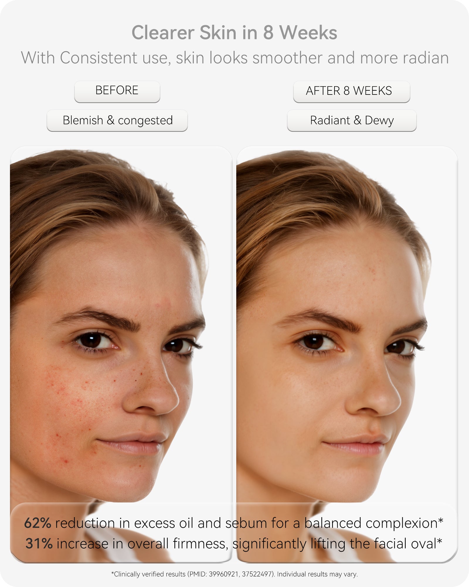 Lumefu Nimbus LED Light Therapy Mask