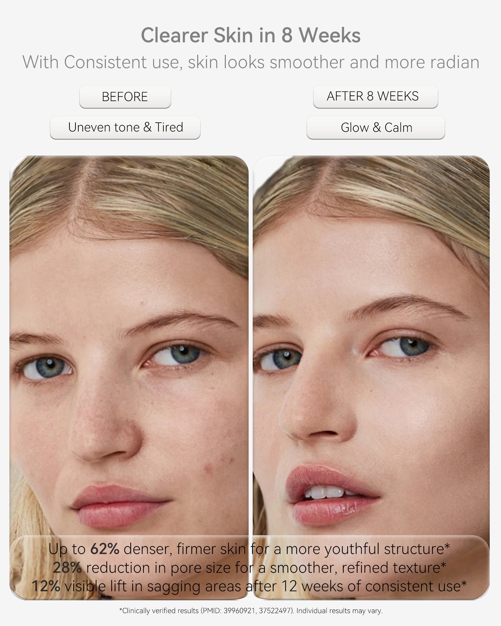 Lumefu Nimbus LED Light Therapy Mask