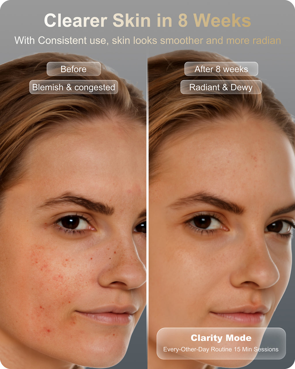 Lumefu Nimbus LED Light Therapy Mask