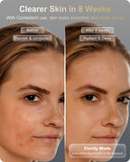 Lumefu Nimbus LED Light Therapy Mask
